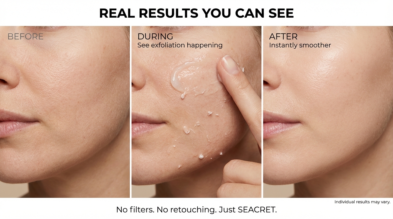 peeling gel